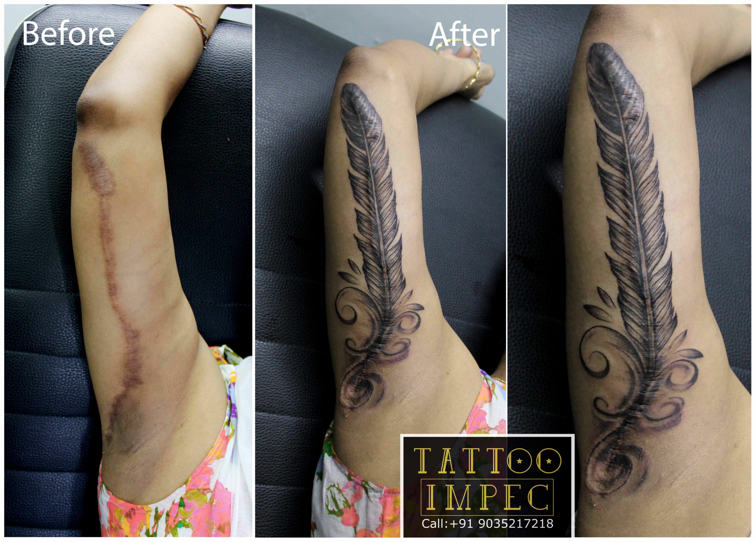 Work in Progress Scar Cover-Up Tattoo