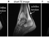 dualEcho_sagittal